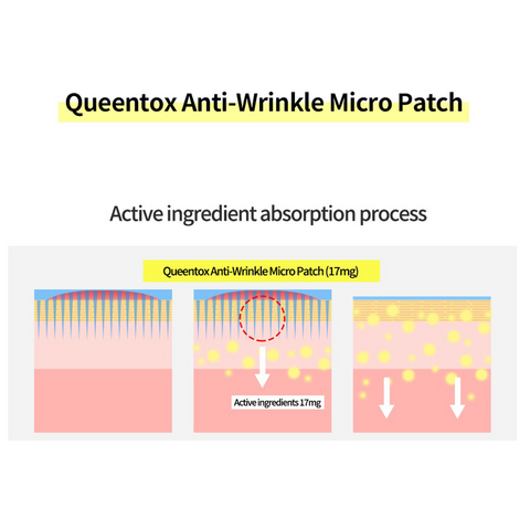 Queentox Anti-Wrinkle Micropatch 3packs (2ea/pack) / 눈가 눈밑 주름 팩 안티링클 마이크로 아이 패치 3개