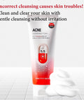 Buy face wash for acne skin in Singapore - Pretty Skin pH 5.5 Acne Cleansing Foam