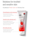Buy facial foam for acne prone skin in Singapore - Pretty Skin pH 5.5 Acne Cleansing Foam