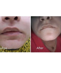 Buy skin care to heal breakouts and acne - COSRX Salicylic Acid Daily Gentle Cleanser